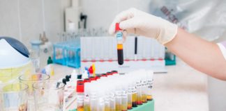 Teva Pharmaceuticals: Chemistry & Pharma Quality Tech Post
