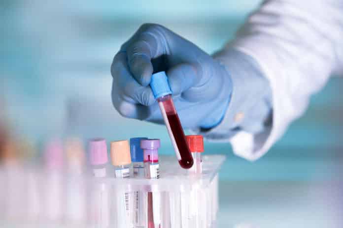 BITS PILANI Invites Applications for JRF Post in Department of Chemistry