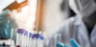 Syngene Recruiting Chemistry & Pharma Candidates | In vitro ADME Post