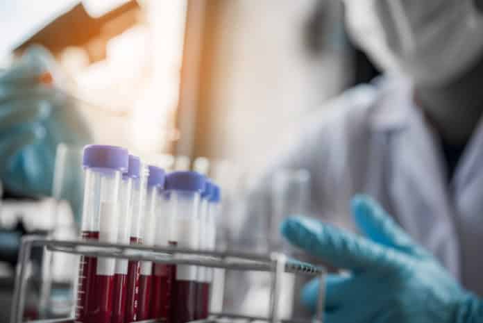 Syngene Recruiting Chemistry & Pharma Candidates | In vitro ADME Post
