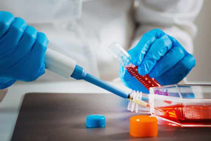 Msc Chemistry Quality Control Technician Post @ Teva Pharmaceutical