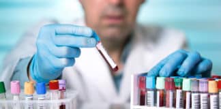 M Pharma & Chemistry Jobs at Cipla | Formulation Analyst Post