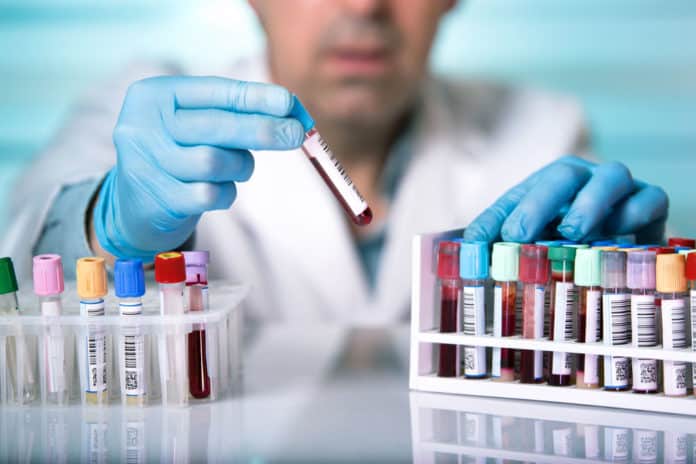 M Pharma & Chemistry Jobs at Cipla | Formulation Analyst Post