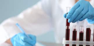 Chemistry & Pharma Bioanalytical Auditor Post @ Syngene