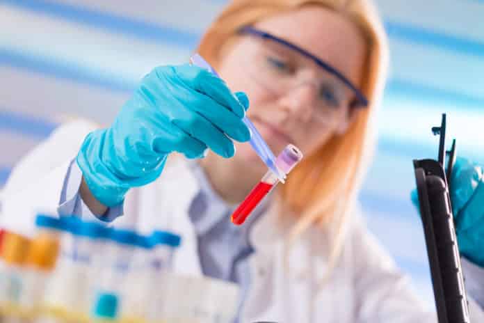 Teva Hiring Chemistry & Pharma Candidates- Apply Online