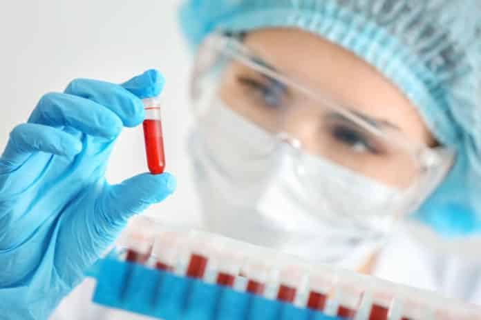 Merck Hiring Chemistry Candidates - Technical Services Job Opening