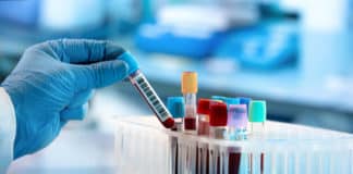 IACS Kolkata Research Associate Job Opening 2019
