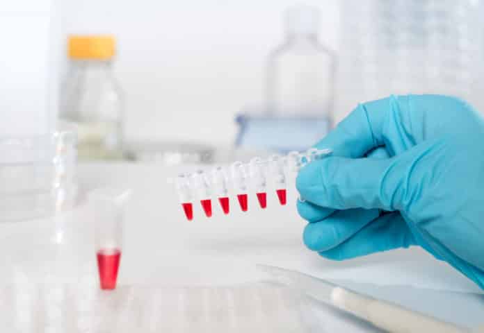 IACS Kolkata Research Job Opening 2019 - Application Details