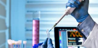 Clinical QA lead Auditor Post Vacancy @ Syngene
