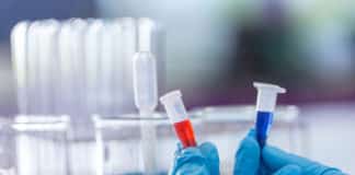 Chemistry JRF Leading to PhD Opportunity at Madurai Kamaraj University