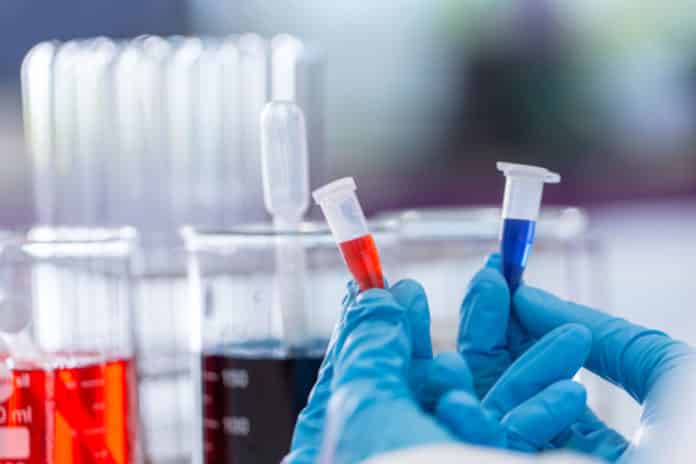 Chemistry JRF Leading to PhD Opportunity at Madurai Kamaraj University