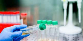 University of Kalyani Chemistry Jobs - JRF Post Vacancy