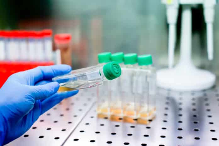 University of Kalyani Chemistry Jobs - JRF Post Vacancy
