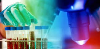 B.Pharma Quality Job Opening 2019 @ Teva - Apply