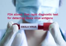 Diagnostic Test for Ebola virus Is Allowed by FDA