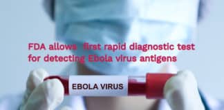 Diagnostic Test for Ebola virus Is Allowed by FDA