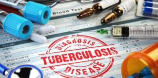 Macleods Gets TB Drug License