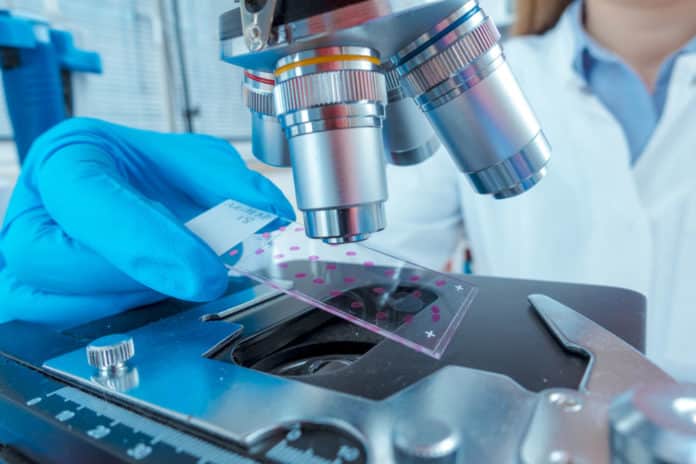 Novozymes Chemistry Job Openings: Research Associate Post