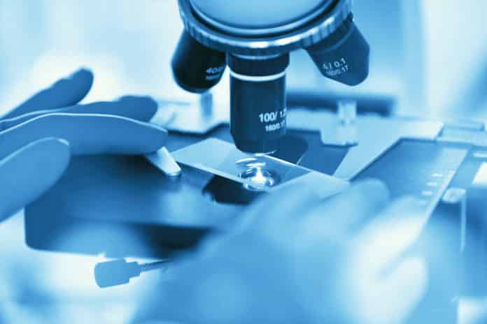 Chemistry Senior Associate Scientist Job Opening @ Syngene