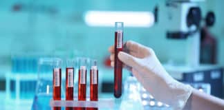 Dr Reddy's Chemistry Job Opening - Analytical Scientist