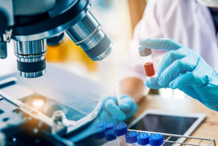 Syngene Associate Scientist Job - Msc Chemistry Job Opening