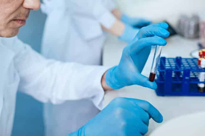 IACS Chemistry Jobs 2020 - Junior Research Fellow Post