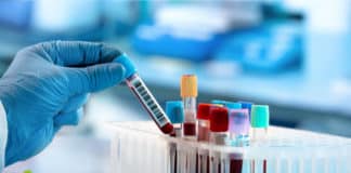 Novartis Pharma CDM Job Vacancy 2020 - Apply Online